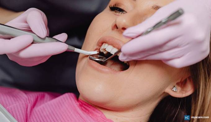 Five Useful Tips From Experts In Tooth Filling Cost In Dubai.