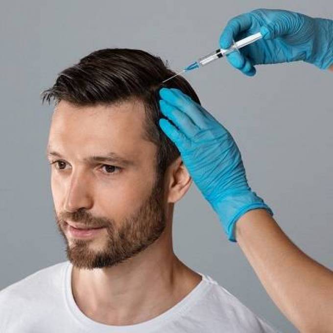 PRP Therapy for Men: A Growing Trend in Hair Restoration in Dubai