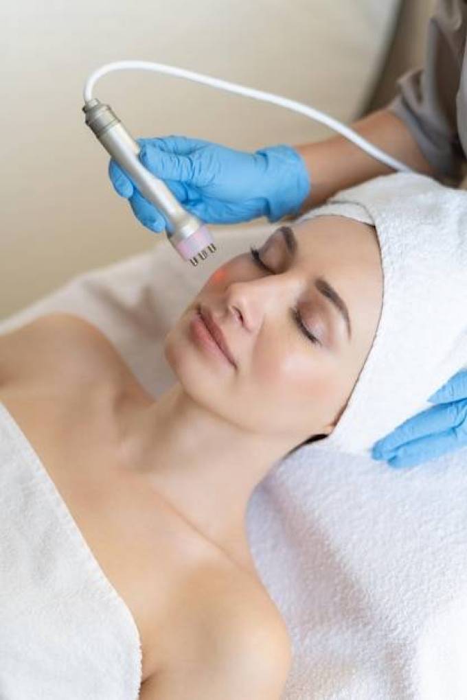 Laser Hair Removal for the Face: A Permanent Solution