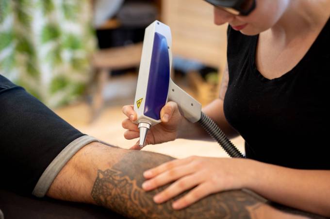 Experience the Best in Laser Tattoo Removal Today