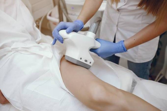 Fractional CO2 Laser Treatment for Stretch Marks: How It Works