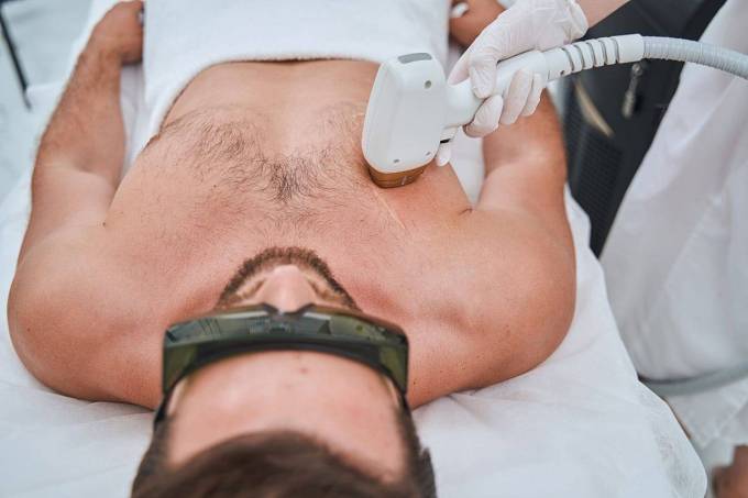 Is it Haram to Do Laser Hair Removal? A Faith-Based Inquiry