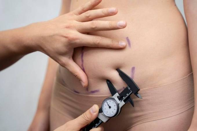 Laser Liposuction in Dubai: A Smart Choice for You