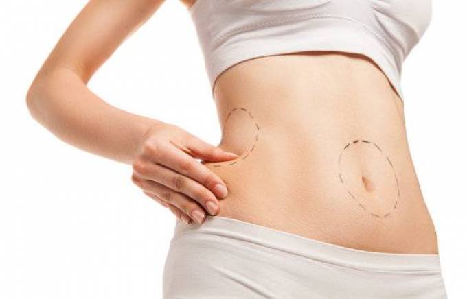 Embrace Your New Body with Liposuction