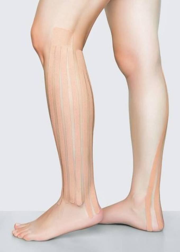 Calf Reduction Techniques: A Step-by-Step Approach to Achieving Toned Legs