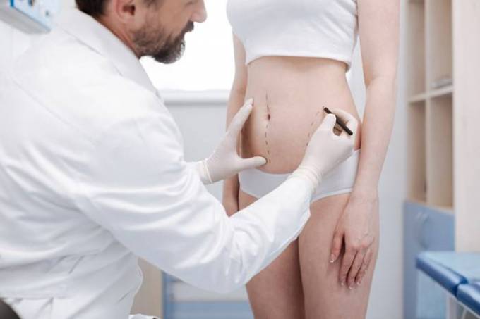 Liposuction: Say Goodbye to Stubborn Fat