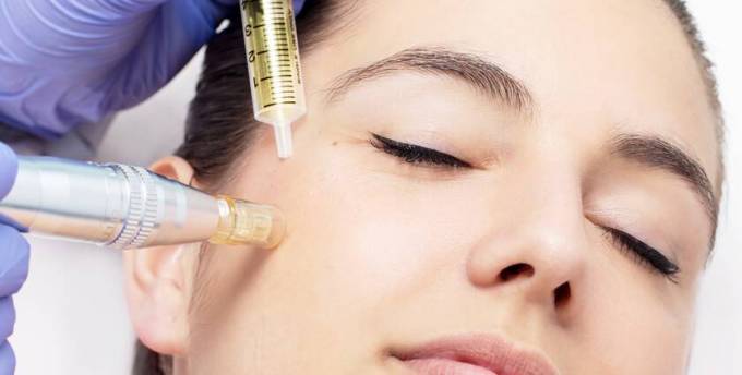 Does mesotherapy thicken skin?