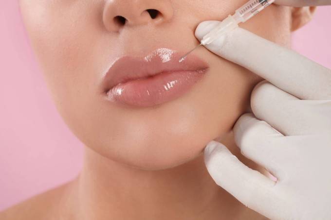 What Ingredients Are in Lip Fillers Injections?