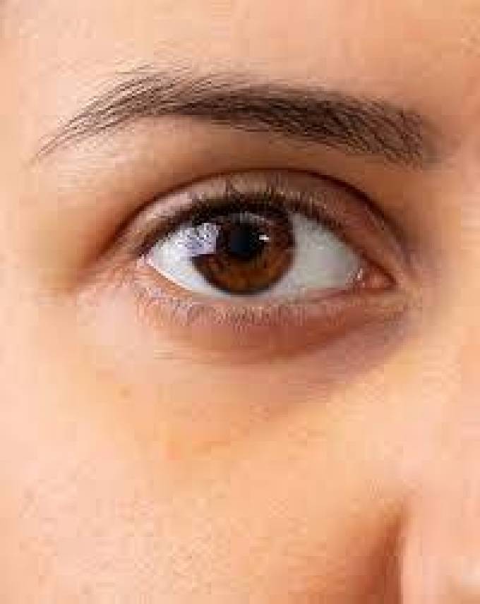 What Are the Latest Techniques in Eye Bag Removal?