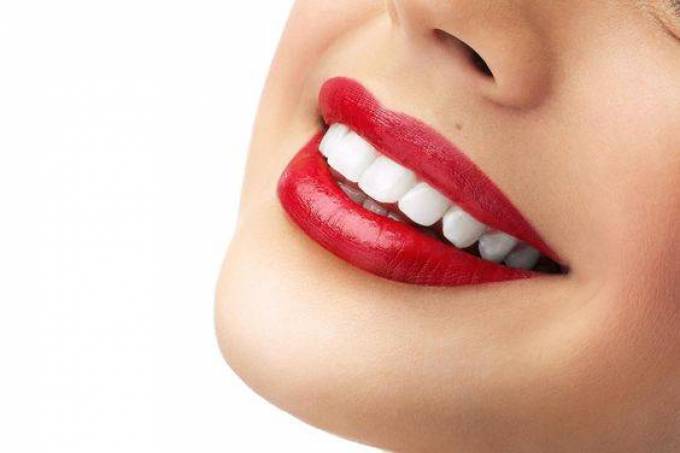 Why Silicon Oasis Residents Love Teeth Whitening Treatments