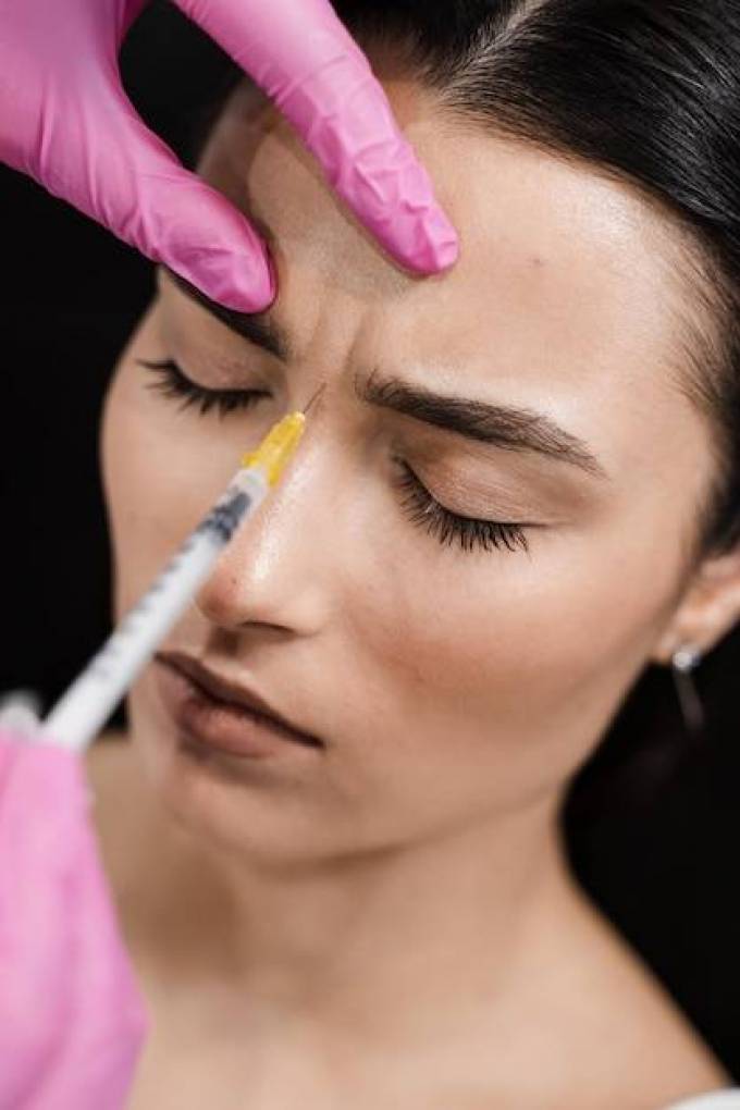 How long does effects of dermal fillers last?