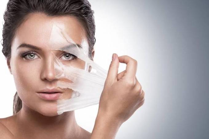 Do chemical peels brighten skin?