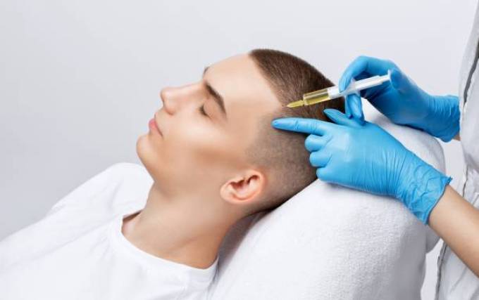 How PRP Hair Therapy Helps Hair Fall?