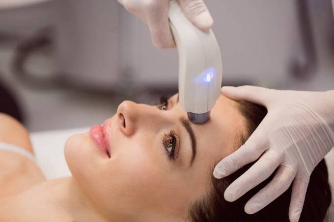 Can Fractional CO2 Laser Reduce Pores?