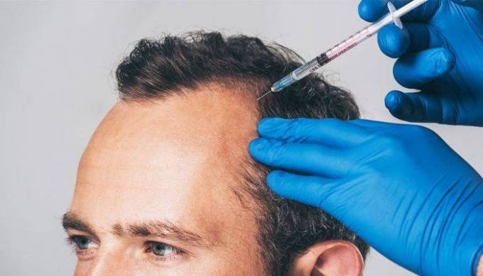 How Much Should You Expect to Pay for PRP Hair Therapy?