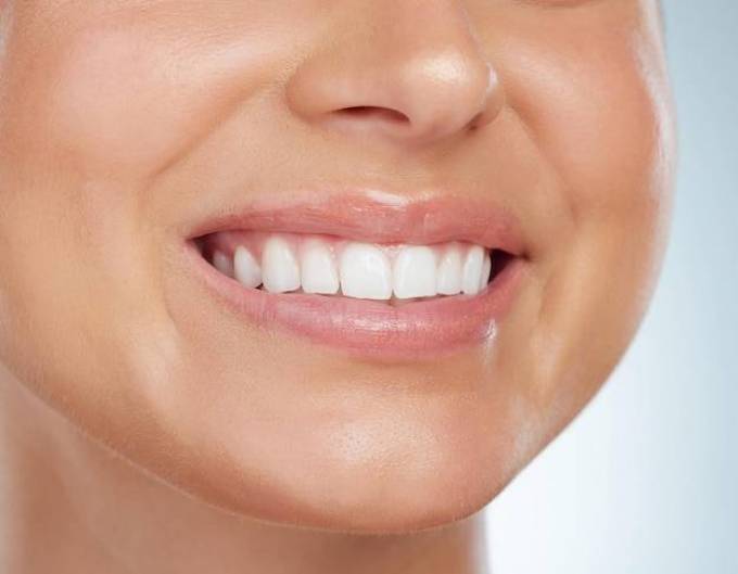 What is the concept of hollywood smile design?