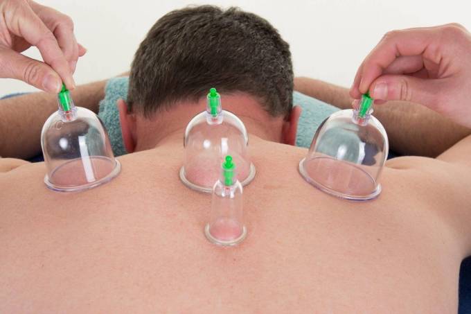 How does Hijama heal?