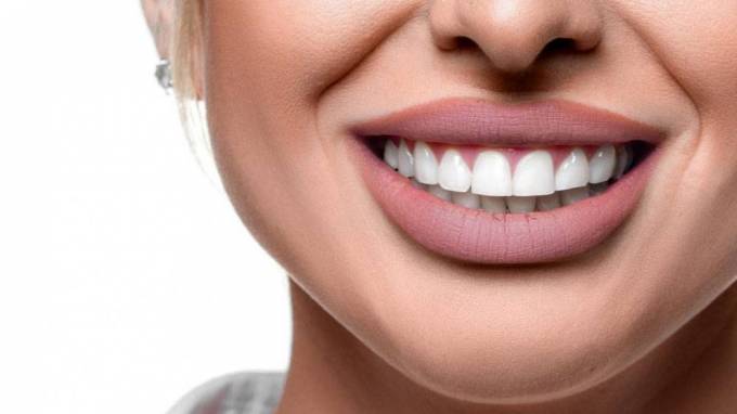 Is Hollywood smile a good idea?