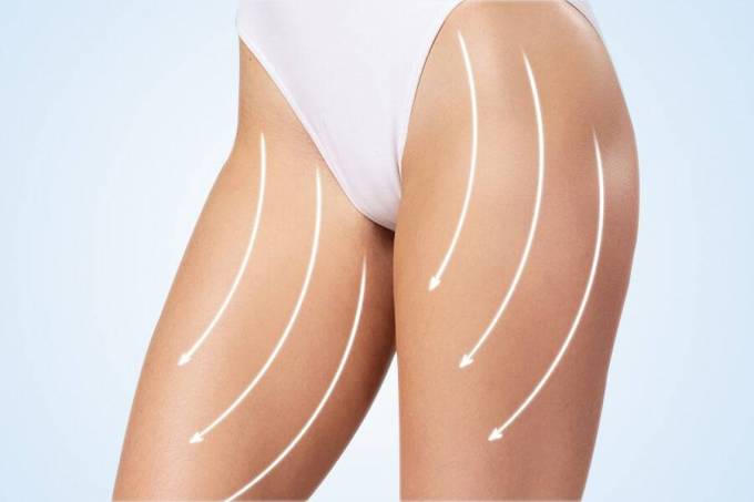 Can a Thigh Lift Be Non-Surgical?