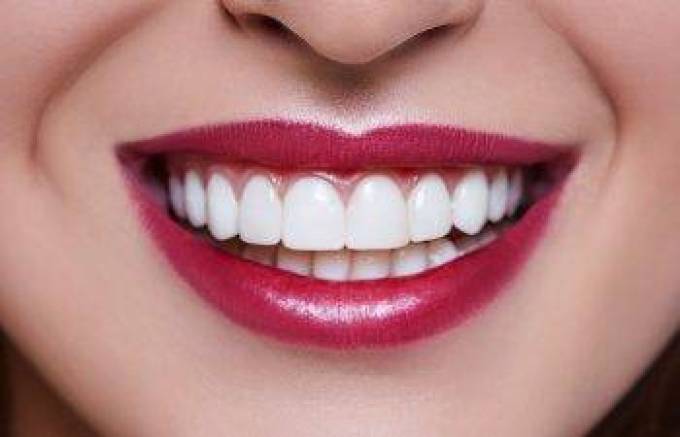 Can Sensitive Teeth Be Whitened?