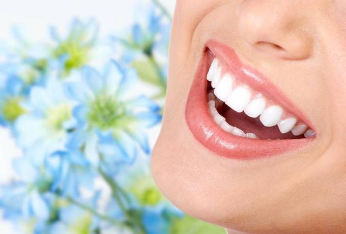 Is teeth whitening permanent?